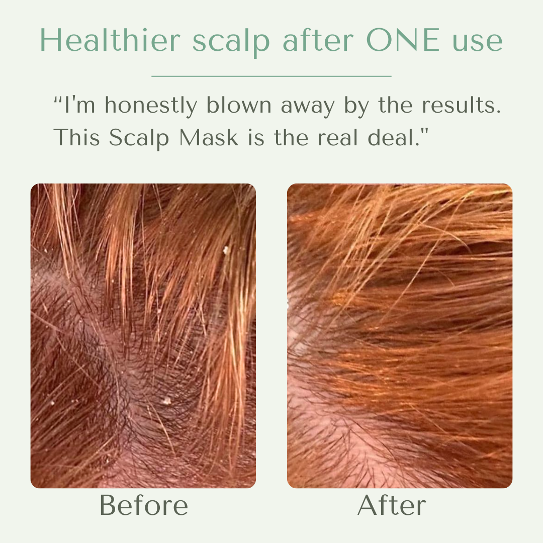 Yobee Restorative Scalp Mask™ - Image 8