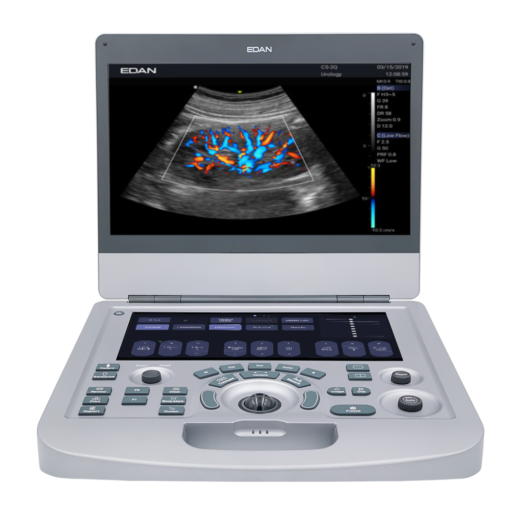 Edan Acclarix AX2 Compact Color Doppler Ultrasound System - Image 4