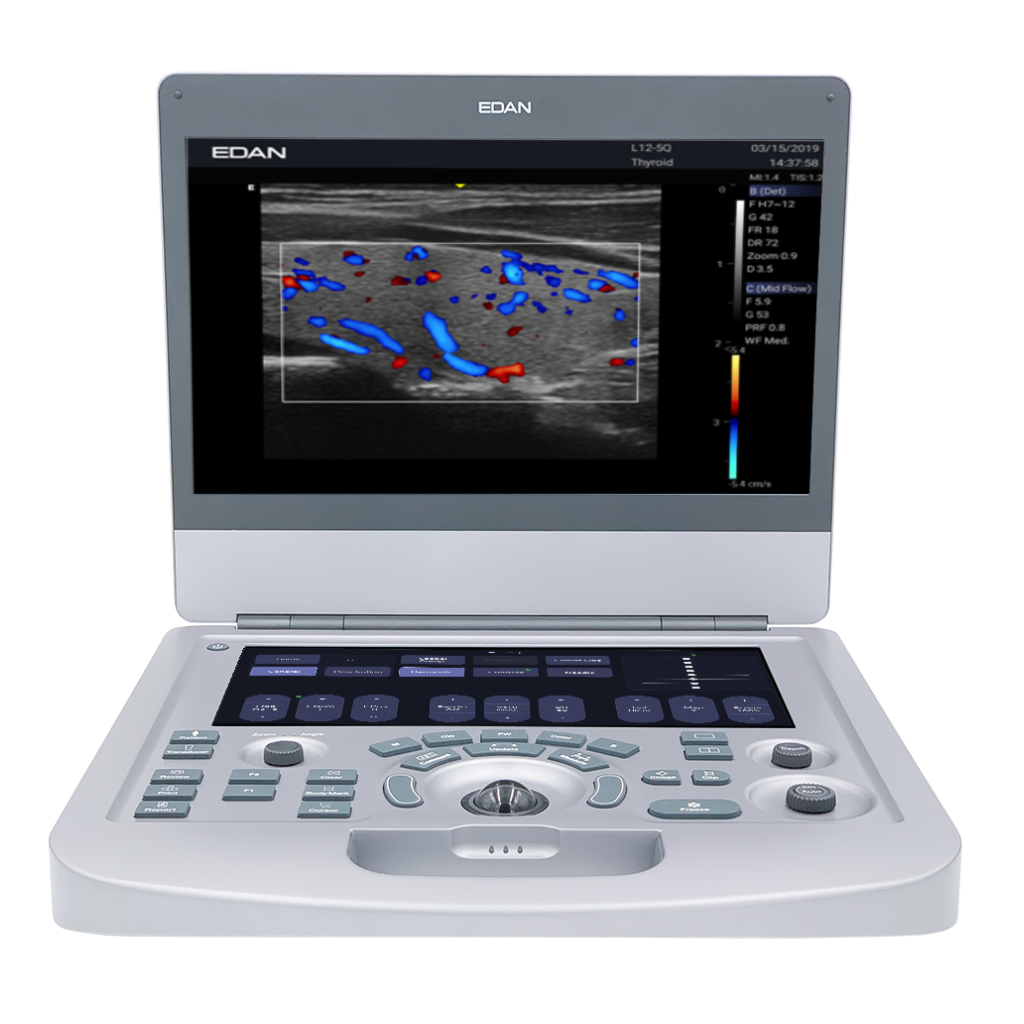 Edan Acclarix AX2 Compact Color Doppler Ultrasound System