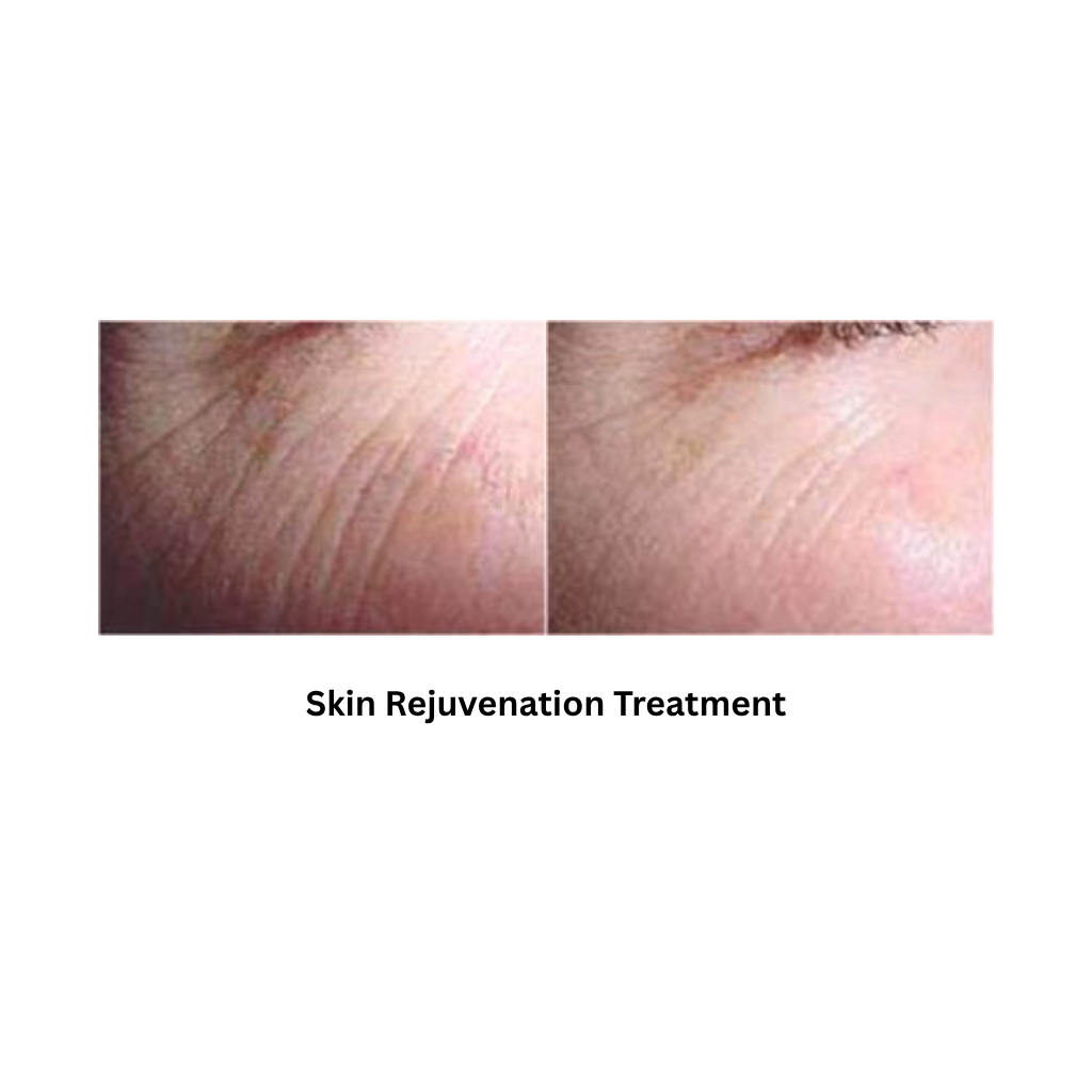 Body Shape RF Body Contouring & Skin Rejuvenation System - Image 6