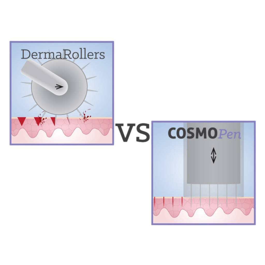 CosmoPen Microneedling System - Image 5