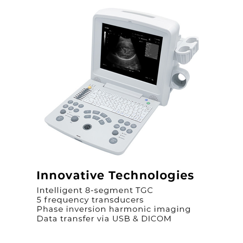 Edan DUS60 Diagnostic Ultrasound System - Image 2