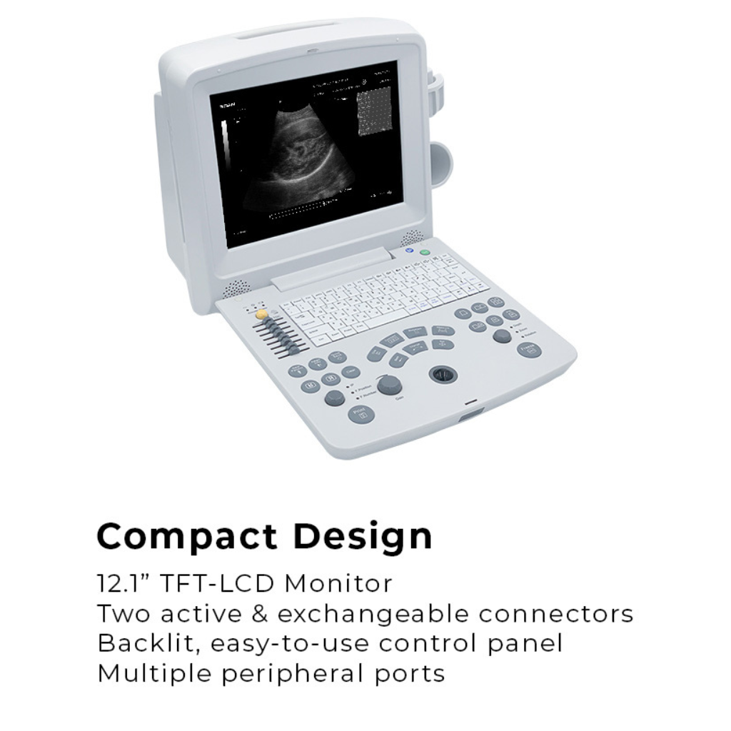 Edan DUS60 Diagnostic Ultrasound System - Image 3