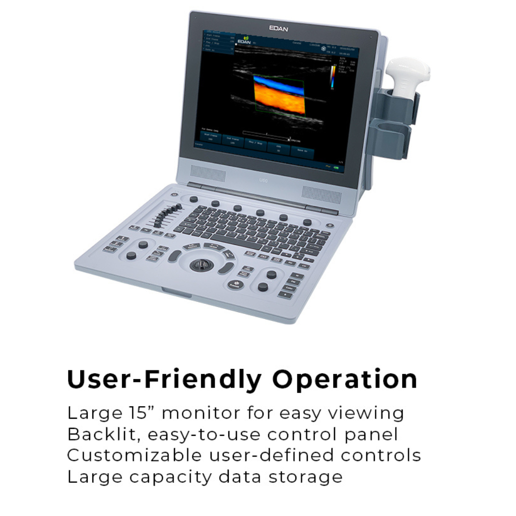 Edan U60 Diagnostic Ultrasound System - Image 2