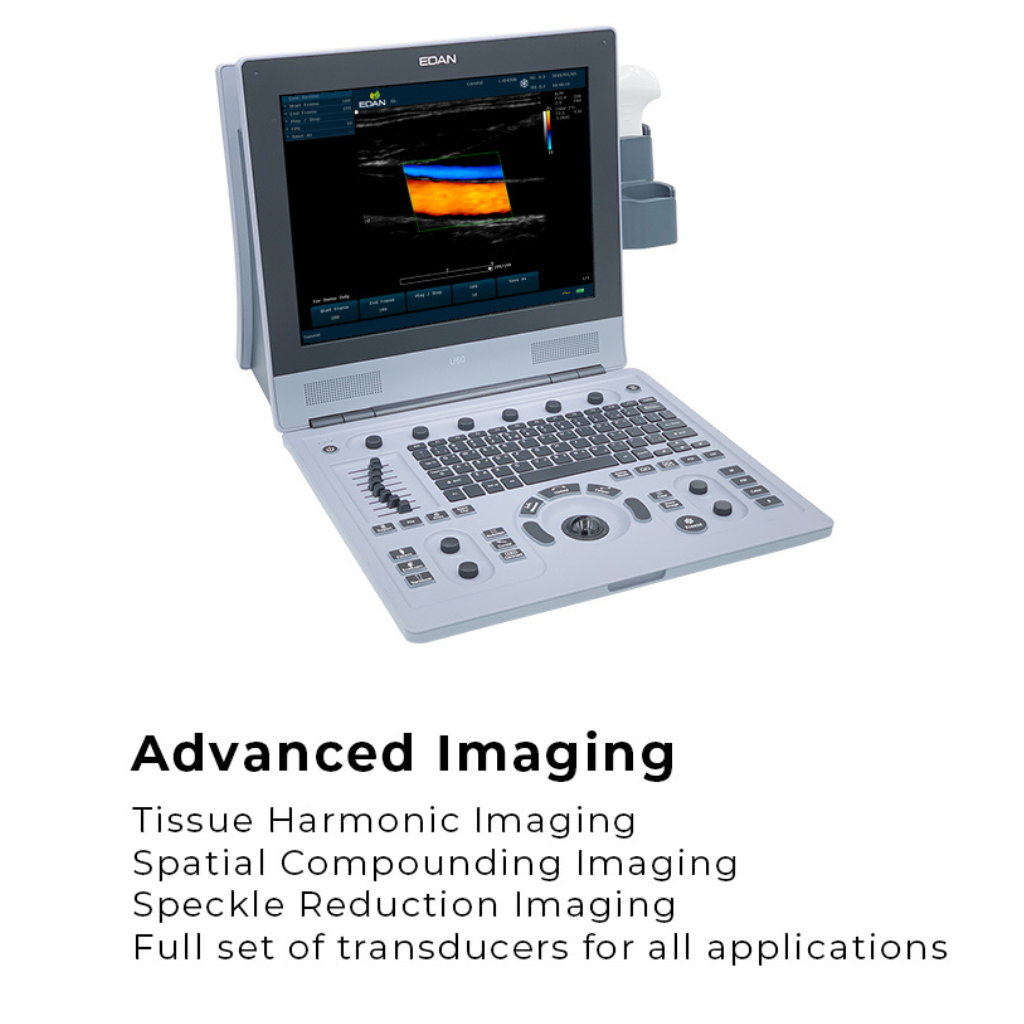 Edan U60 Diagnostic Ultrasound System - Image 3