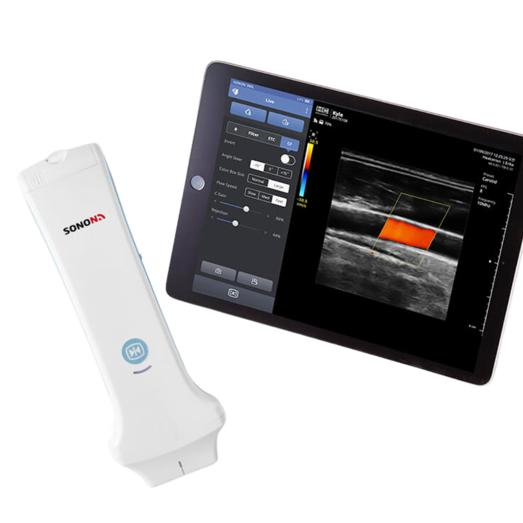 Healcerion SONON Linear Handheld Ultrasound (300L) - Image 5