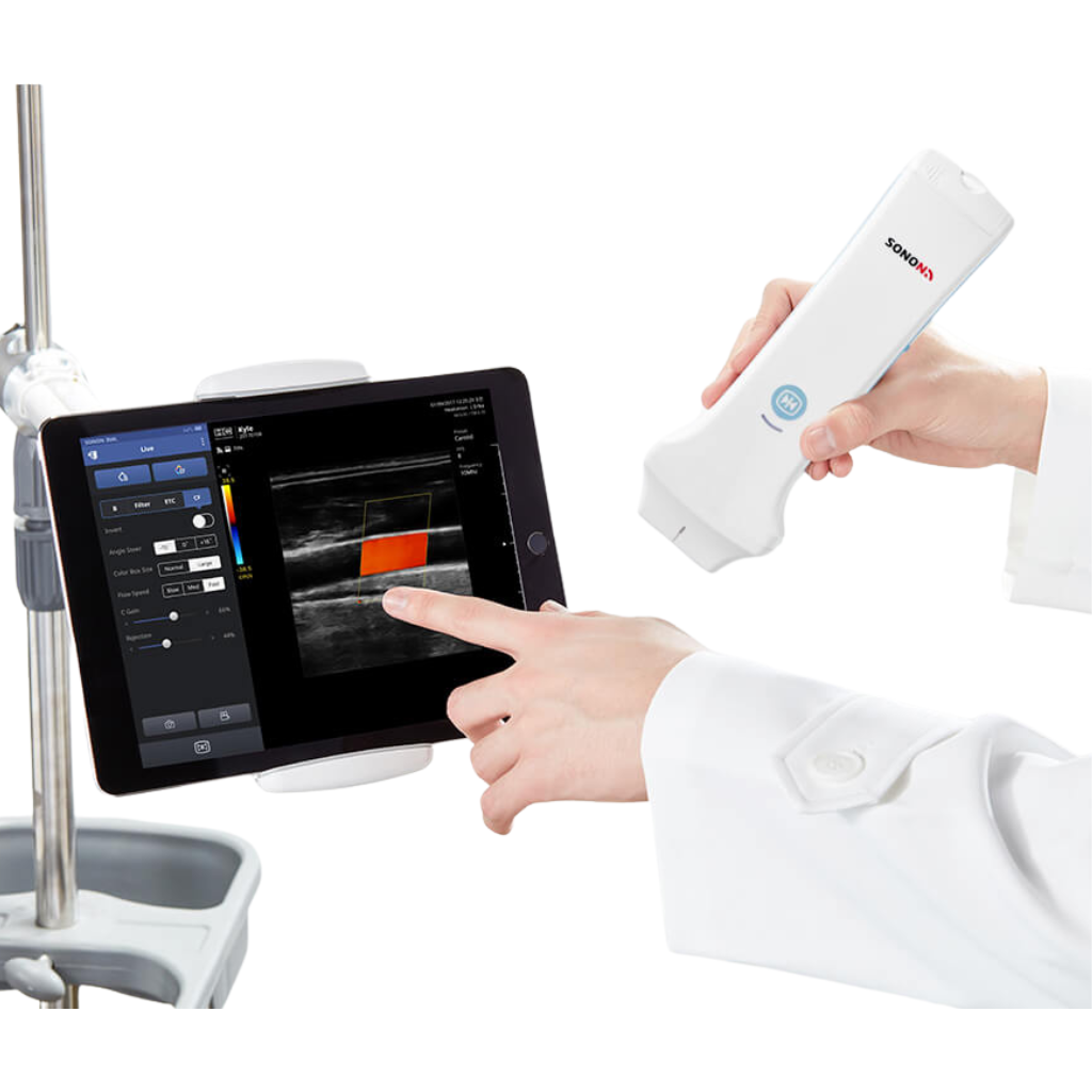 Healcerion SONON Linear Handheld Ultrasound (300L) - Image 6